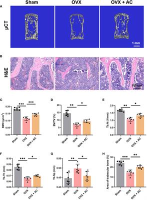 Aconine attenuates osteoclast-mediated bone resorption and ferroptosis to improve osteoporosis via inhibiting NF-κB signaling